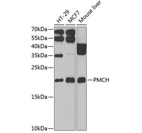 Western Blot - Anti-MCH Antibody (A9971) - Antibodies.com