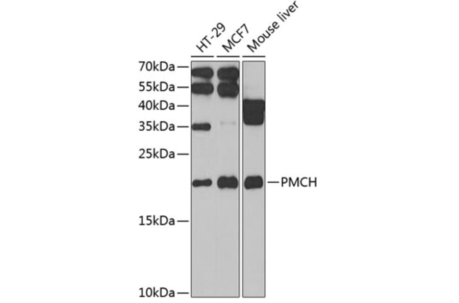 Western Blot - Anti-MCH Antibody (A9971) - Antibodies.com