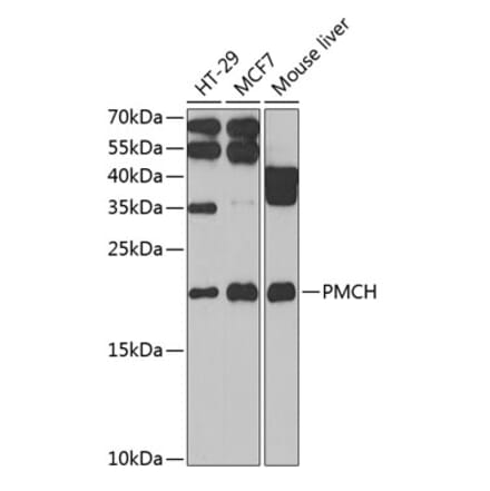 Western Blot - Anti-MCH Antibody (A9971) - Antibodies.com