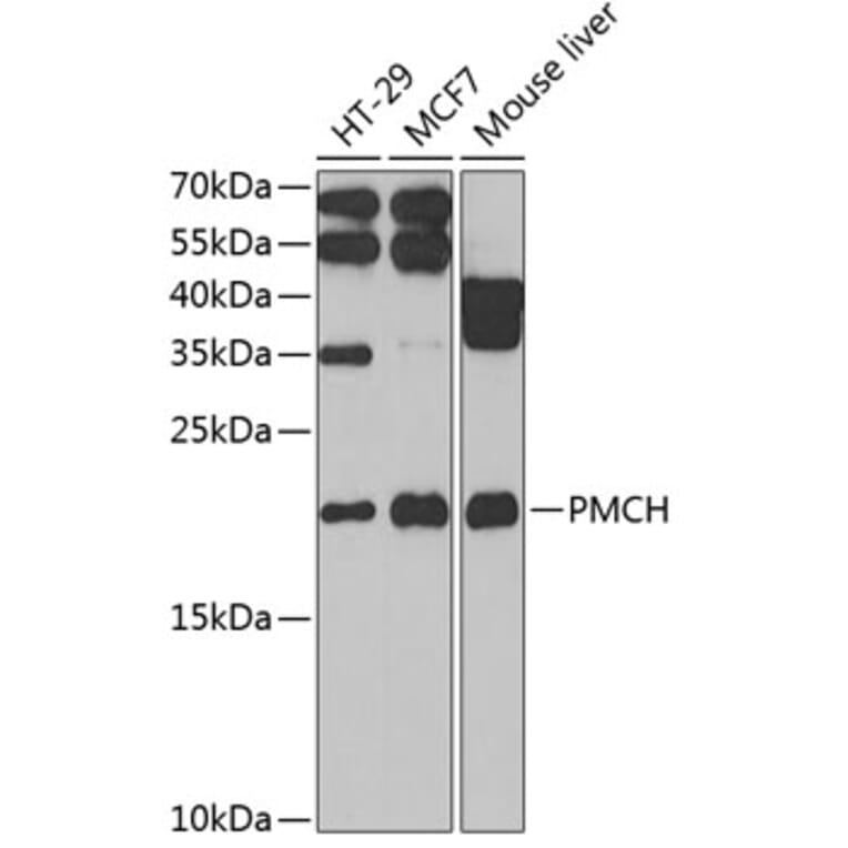 Western Blot - Anti-MCH Antibody (A9971) - Antibodies.com