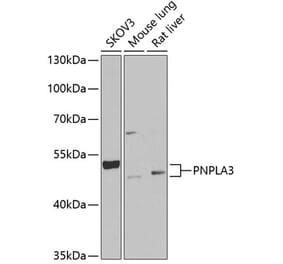 Western Blot - Anti-PNPLA3 Antibody (A9972) - Antibodies.com