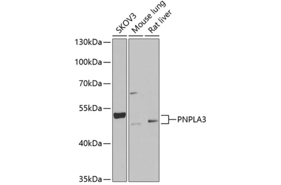Western Blot - Anti-PNPLA3 Antibody (A9972) - Antibodies.com