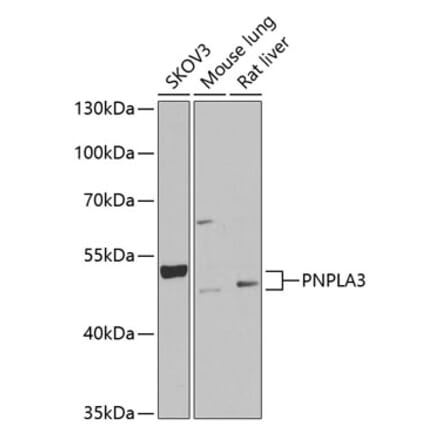 Western Blot - Anti-PNPLA3 Antibody (A9972) - Antibodies.com