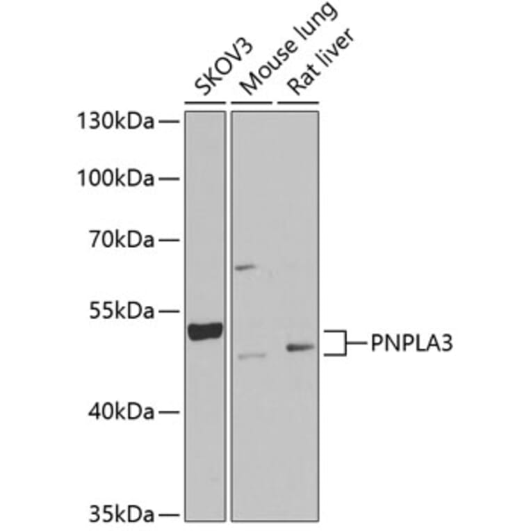 Western Blot - Anti-PNPLA3 Antibody (A9972) - Antibodies.com