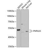 Western Blot - Anti-PNPLA3 Antibody (A9972) - Antibodies.com