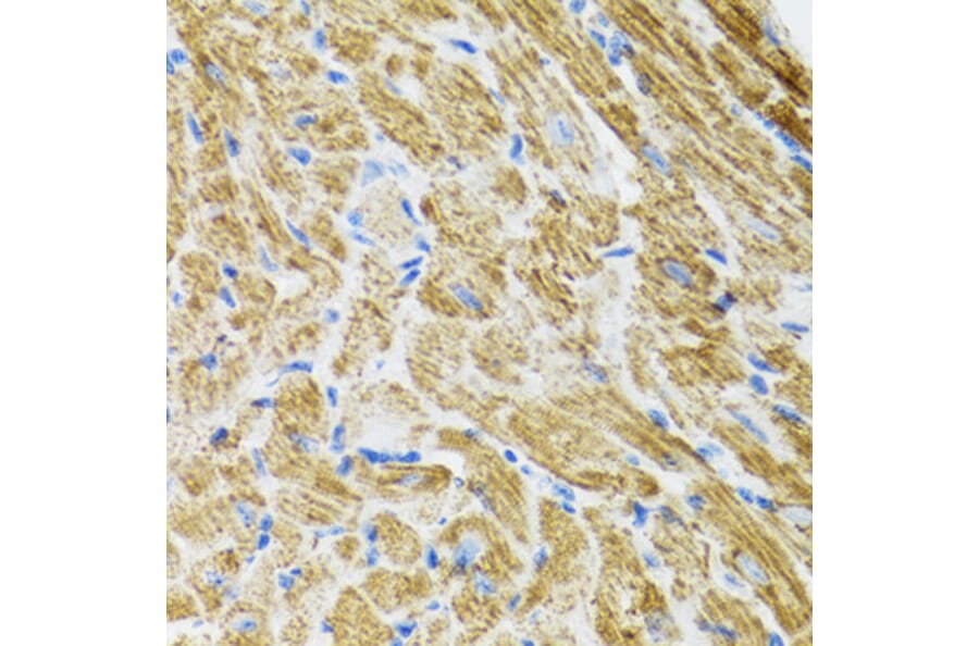 Immunohistochemistry - Anti-POLG2 Antibody (A9973) - Antibodies.com