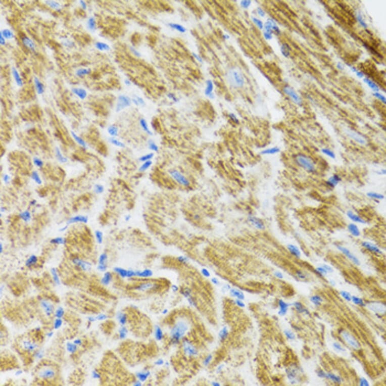 Immunohistochemistry - Anti-POLG2 Antibody (A9973) - Antibodies.com