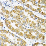 Immunohistochemistry - Anti-POLG2 Antibody (A9973) - Antibodies.com