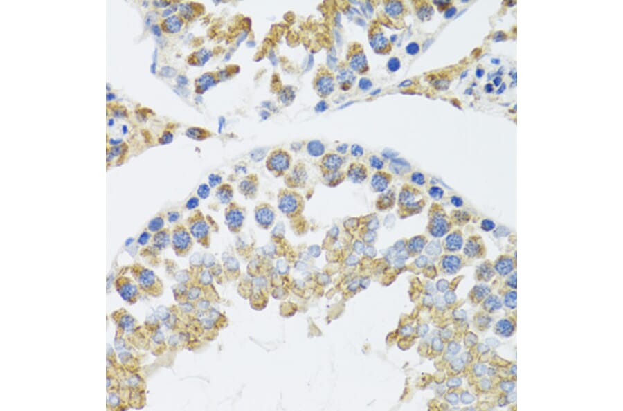 Immunohistochemistry - Anti-POLG2 Antibody (A9973) - Antibodies.com