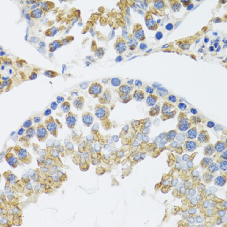 Immunohistochemistry - Anti-POLG2 Antibody (A9973) - Antibodies.com