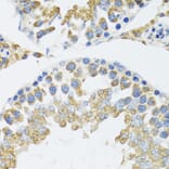 Immunohistochemistry - Anti-POLG2 Antibody (A9973) - Antibodies.com