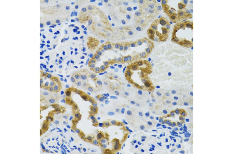 Immunohistochemistry - Anti-POLG2 Antibody (A9973) - Antibodies.com
