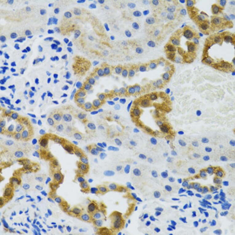 Immunohistochemistry - Anti-POLG2 Antibody (A9973) - Antibodies.com