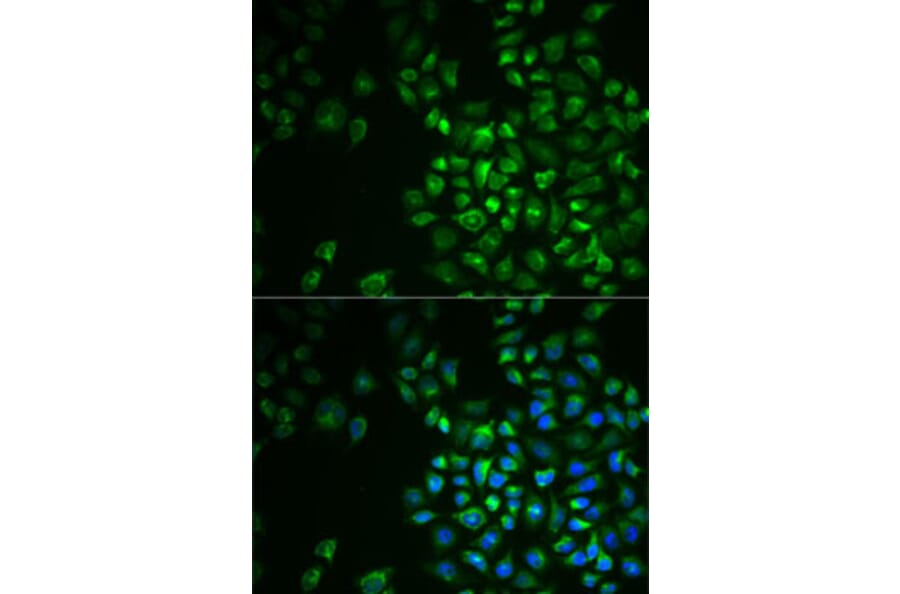 Immunofluorescence - Anti-POLG2 Antibody (A9973) - Antibodies.com