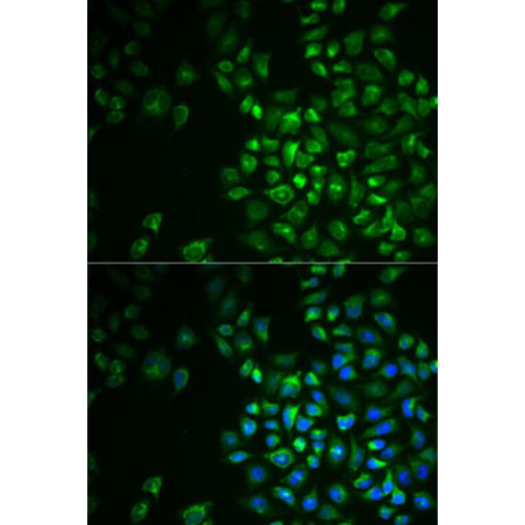 Immunofluorescence - Anti-POLG2 Antibody (A9973) - Antibodies.com