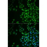 Immunofluorescence - Anti-POLG2 Antibody (A9973) - Antibodies.com