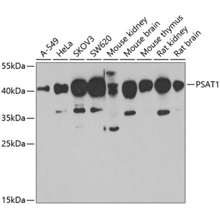 Western Blot - Anti-PSAT1 Antibody (A6707) - Antibodies.com