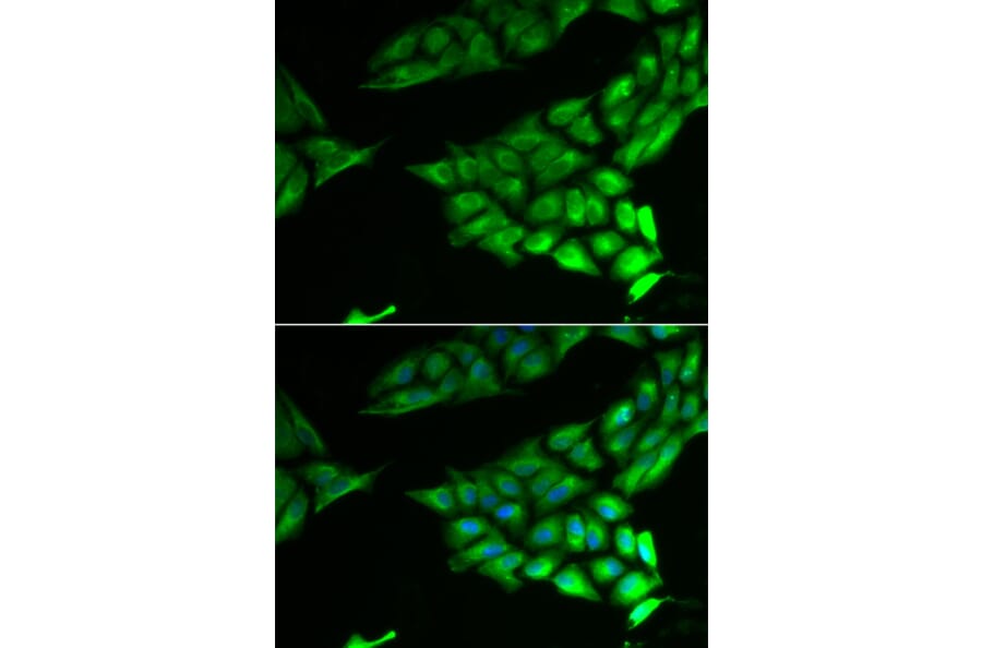 Immunofluorescence - Anti-PSAT1 Antibody (A6707) - Antibodies.com