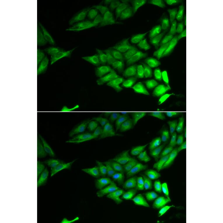 Immunofluorescence - Anti-PSAT1 Antibody (A6707) - Antibodies.com
