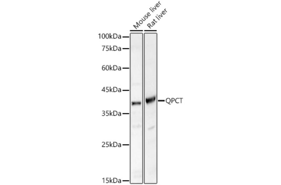 Western Blot - Anti-Glutaminyl cyclase Antibody (A9977) - Antibodies.com