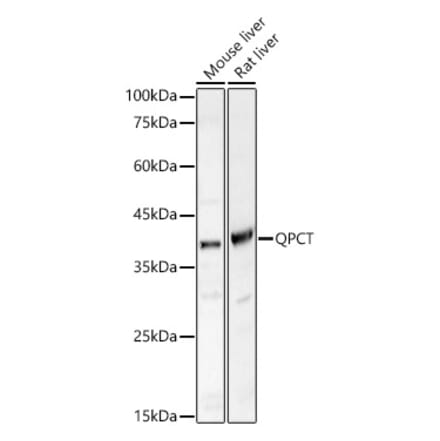 Western Blot - Anti-Glutaminyl cyclase Antibody (A9977) - Antibodies.com