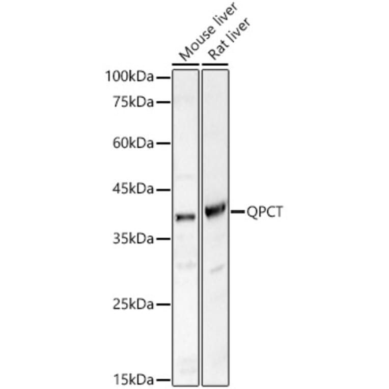 Western Blot - Anti-Glutaminyl cyclase Antibody (A9977) - Antibodies.com