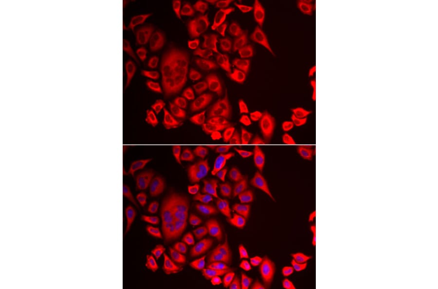 Immunofluorescence - Anti-Glutaminyl cyclase Antibody (A9977) - Antibodies.com