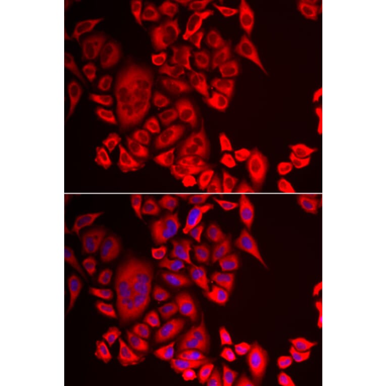 Immunofluorescence - Anti-Glutaminyl cyclase Antibody (A9977) - Antibodies.com