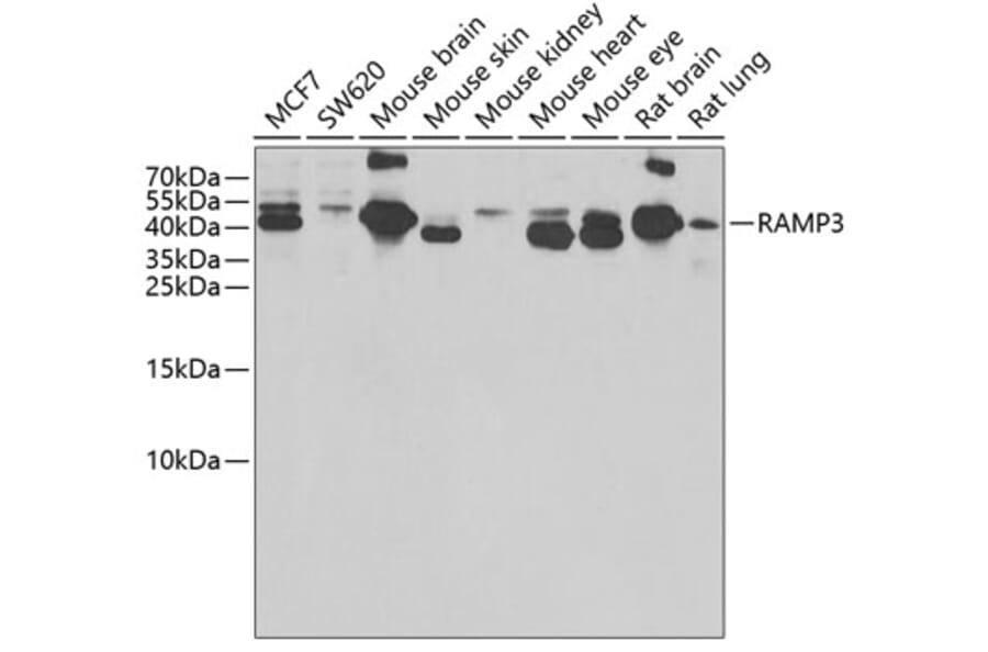 Western Blot - Anti-RAMP3 Antibody (A9978) - Antibodies.com