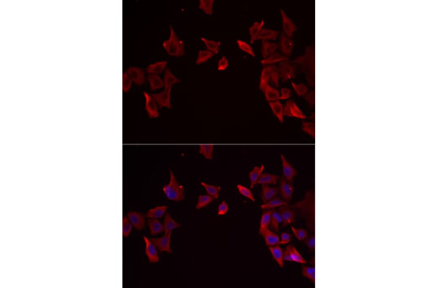 Immunofluorescence - Anti-RAMP3 Antibody (A9978) - Antibodies.com