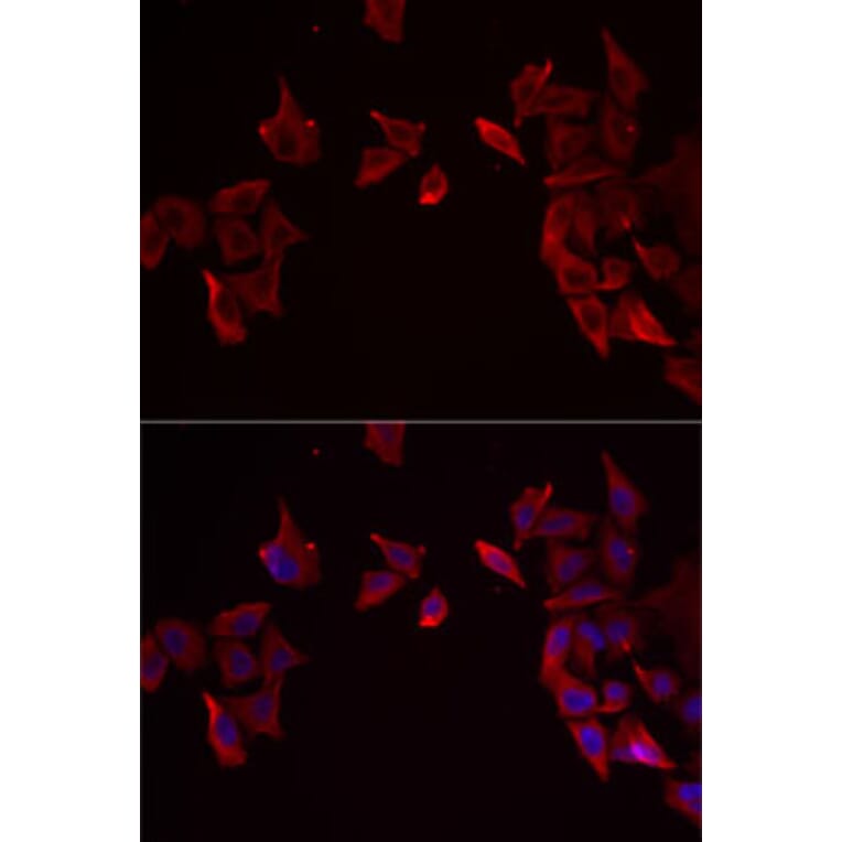 Immunofluorescence - Anti-RAMP3 Antibody (A9978) - Antibodies.com