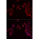 Immunofluorescence - Anti-RAMP3 Antibody (A9978) - Antibodies.com