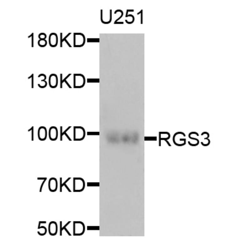 Western Blot - Anti-RGS3 Antibody (A6719) - Antibodies.com