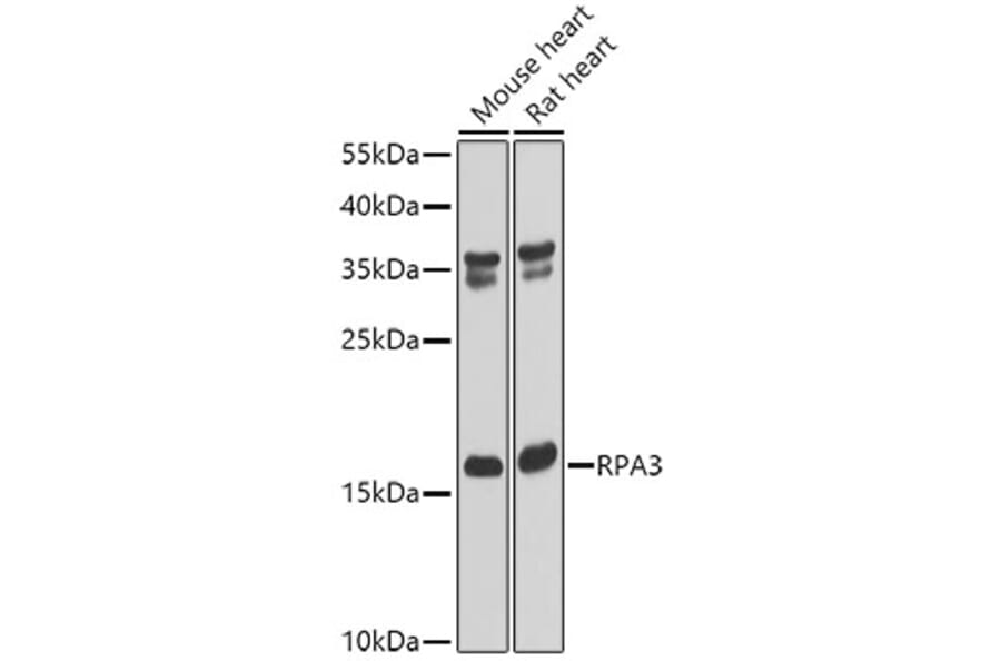 Western Blot - Anti-RPA14/RPA3 Antibody (A9980) - Antibodies.com