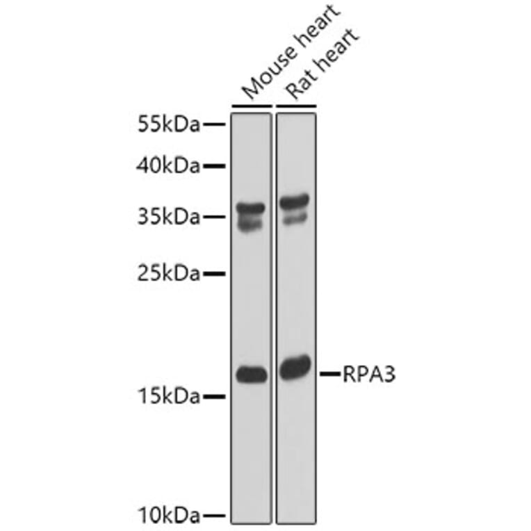 Western Blot - Anti-RPA14 / RPA3 Antibody (A9980) - Antibodies.com