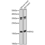 Western Blot - Anti-RPA14 / RPA3 Antibody (A9980) - Antibodies.com