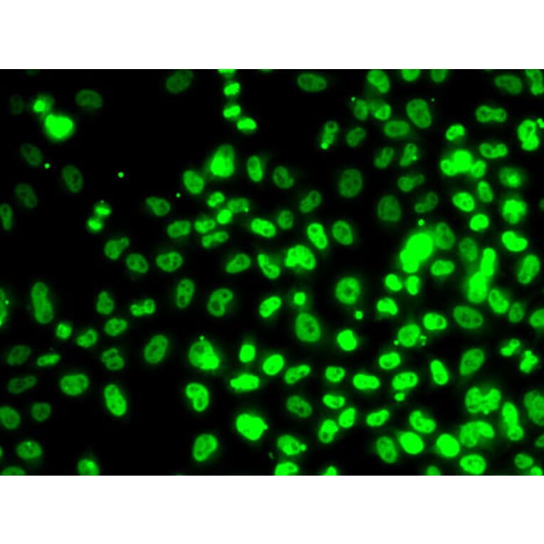 Immunofluorescence - Anti-RPA14 / RPA3 Antibody (A9980) - Antibodies.com