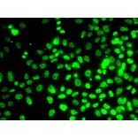 Immunofluorescence - Anti-RPA14 / RPA3 Antibody (A9980) - Antibodies.com