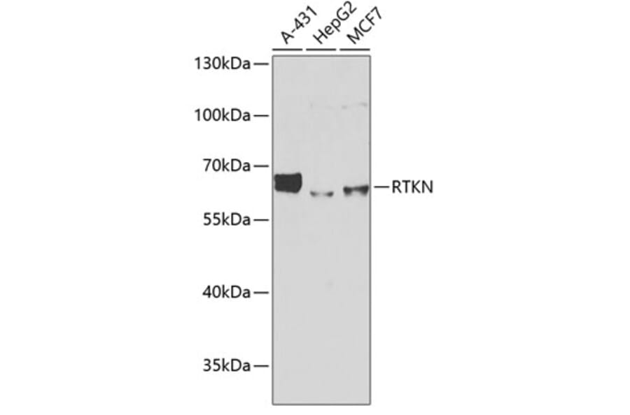 Western Blot - Anti-RTKN/Rhotekin Antibody (A9981) - Antibodies.com