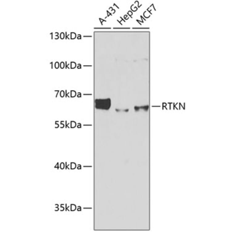 Western Blot - Anti-RTKN/Rhotekin Antibody (A9981) - Antibodies.com