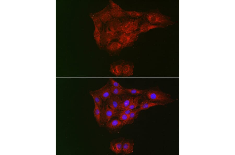 Immunofluorescence - Anti-RTKN/Rhotekin Antibody (A9981) - Antibodies.com