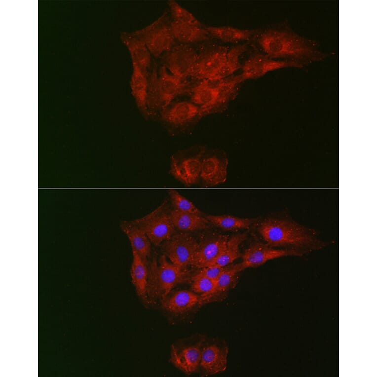 Immunofluorescence - Anti-RTKN/Rhotekin Antibody (A9981) - Antibodies.com