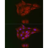Immunofluorescence - Anti-RTKN/Rhotekin Antibody (A9981) - Antibodies.com