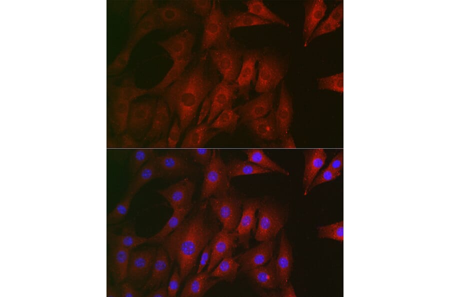 Immunofluorescence - Anti-RTKN/Rhotekin Antibody (A9981) - Antibodies.com