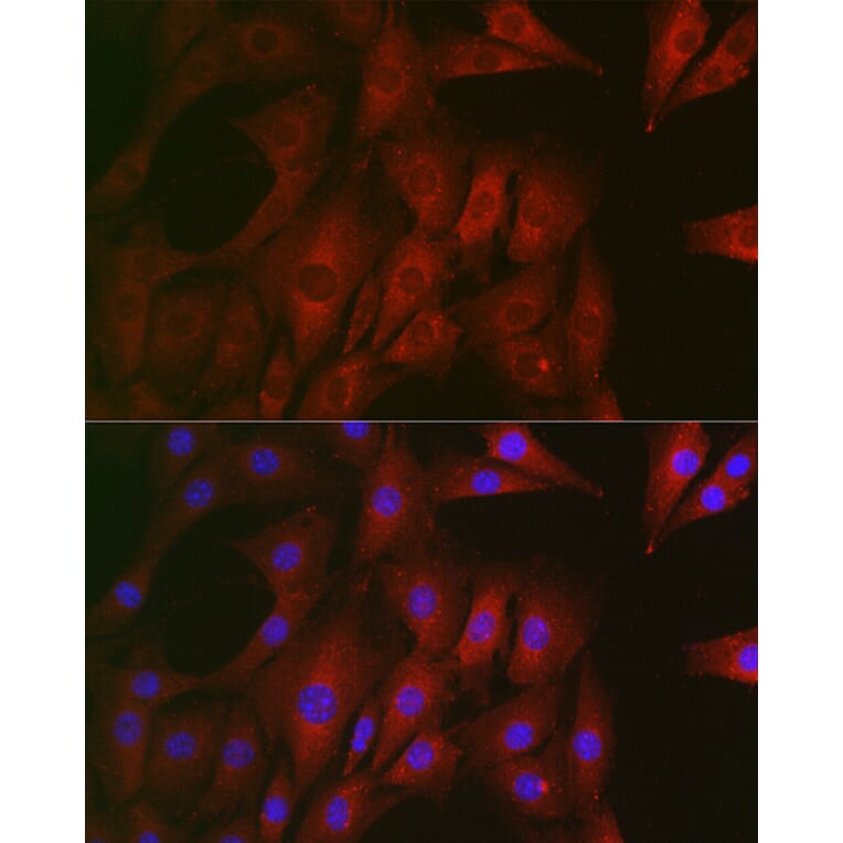 Immunofluorescence - Anti-RTKN/Rhotekin Antibody (A9981) - Antibodies.com