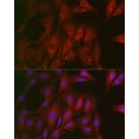 Immunofluorescence - Anti-RTKN/Rhotekin Antibody (A9981) - Antibodies.com