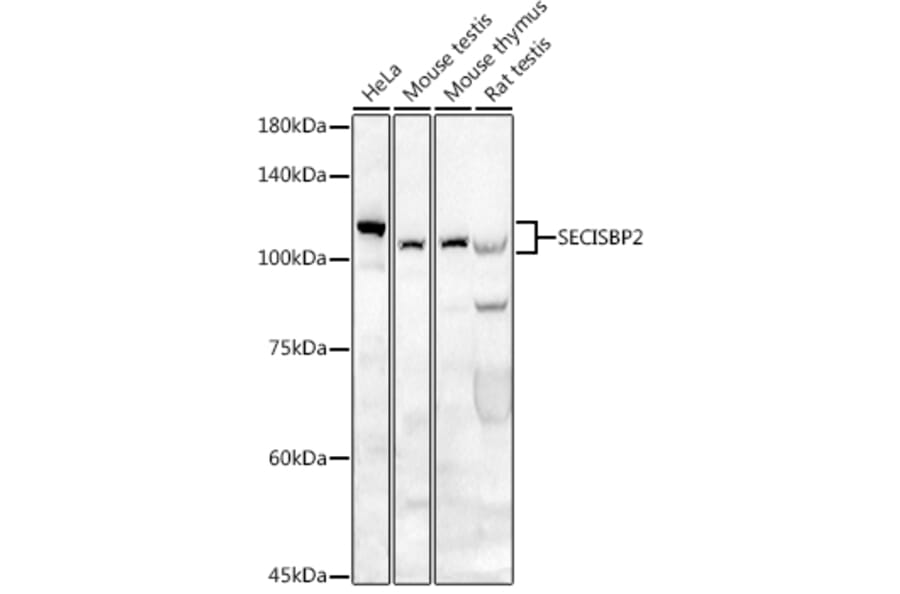 Western Blot - Anti-SECISBP2 Antibody (A9982) - Antibodies.com