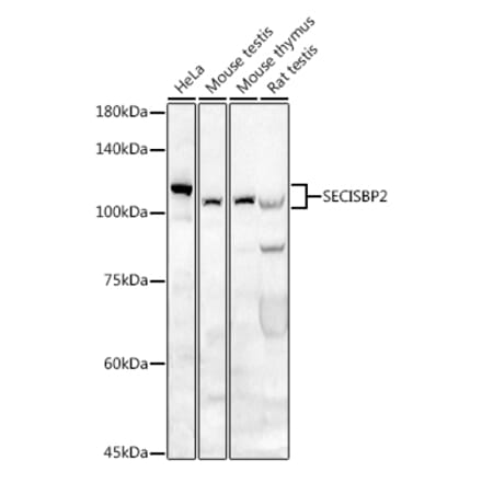 Western Blot - Anti-SECISBP2 Antibody (A9982) - Antibodies.com