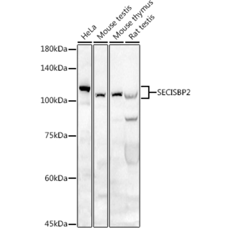 Western Blot - Anti-SECISBP2 Antibody (A9982) - Antibodies.com