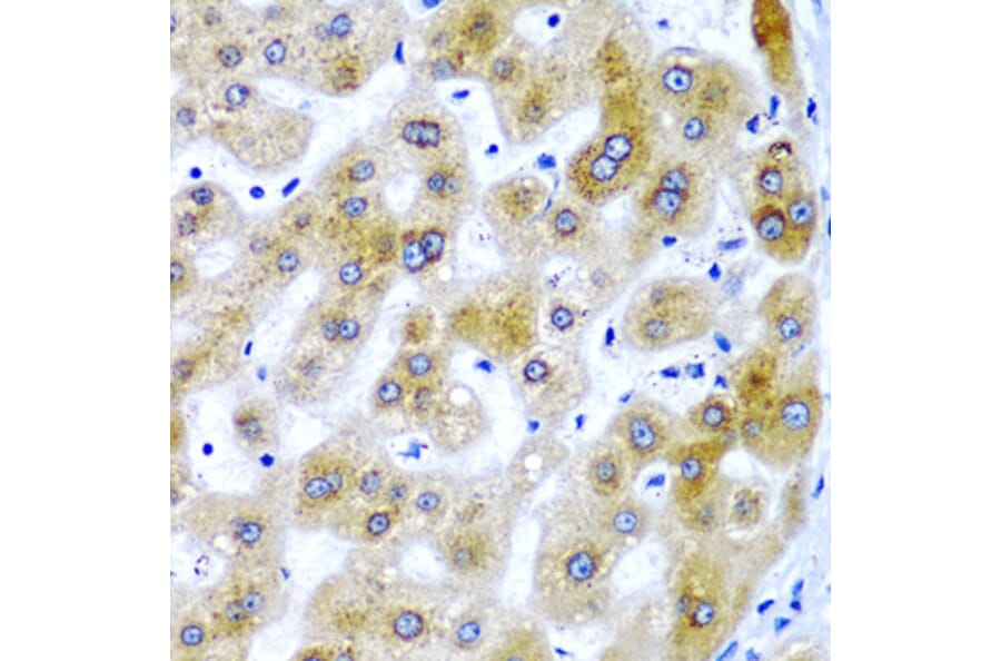 Immunohistochemistry - Anti-SECISBP2 Antibody (A9982) - Antibodies.com